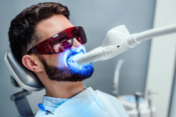 blanqueamiento dental alcobendas