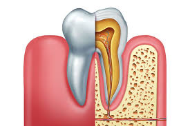 periodoncia alcobendas