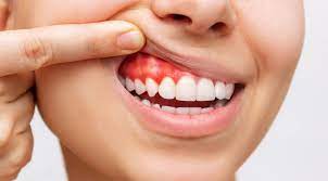 periodoncia